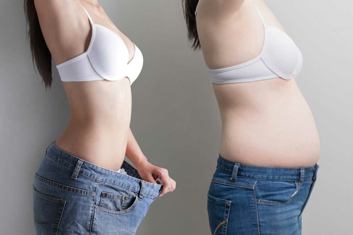 Before and After Liposuction in Miami