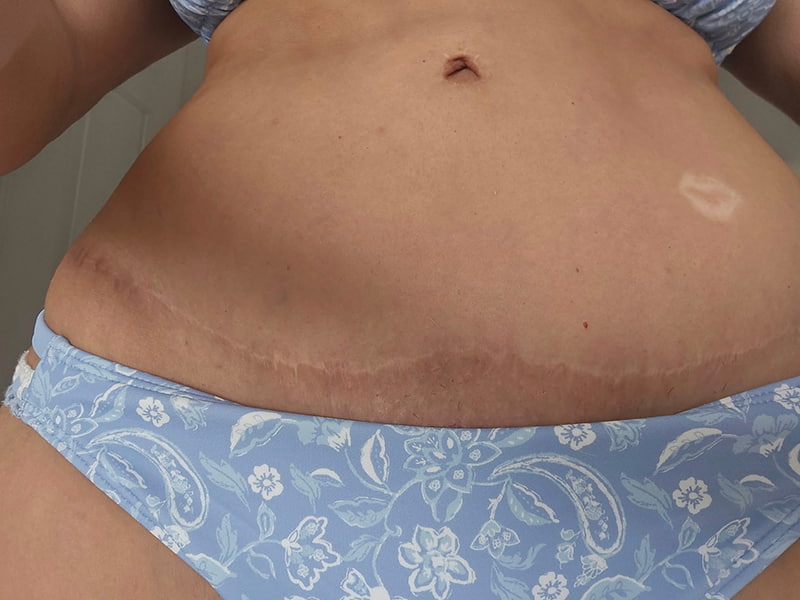 Featured before & after photo
