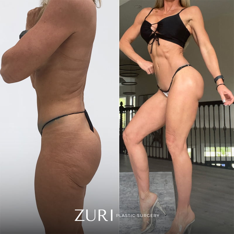 Featured before & after photo