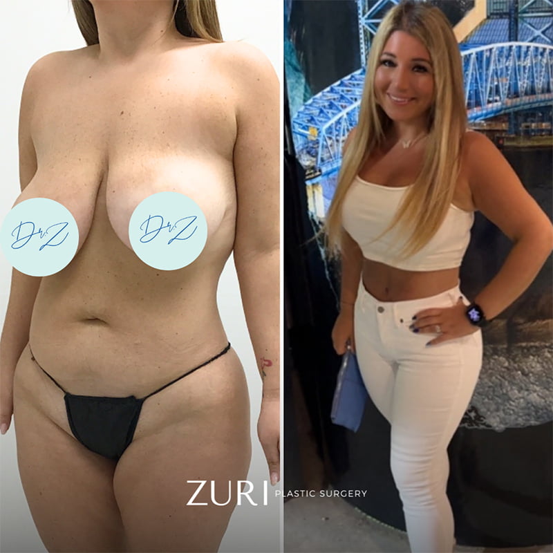 Featured before & after photo