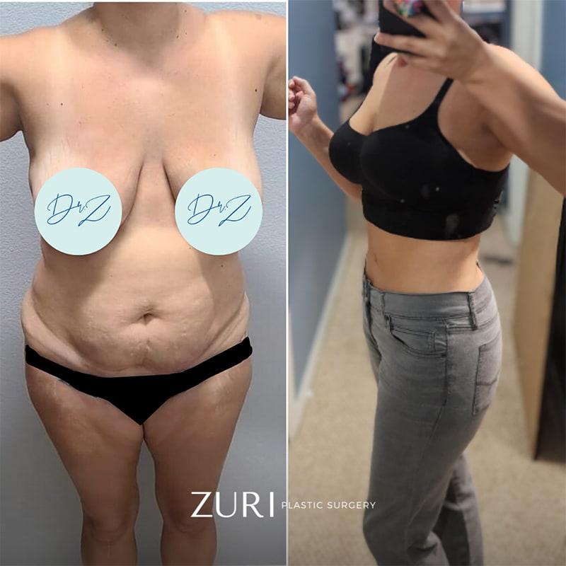 Featured before & after photo