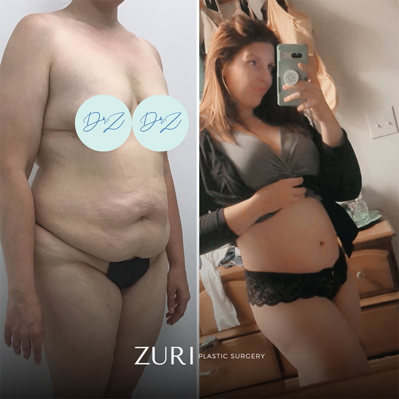 Featured before & after photo