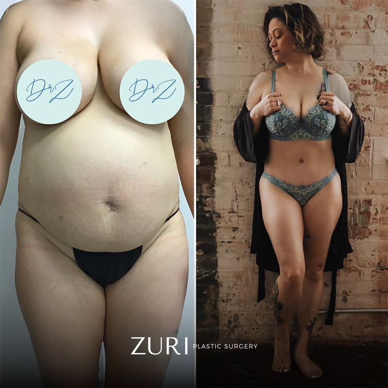 Featured before & after photo