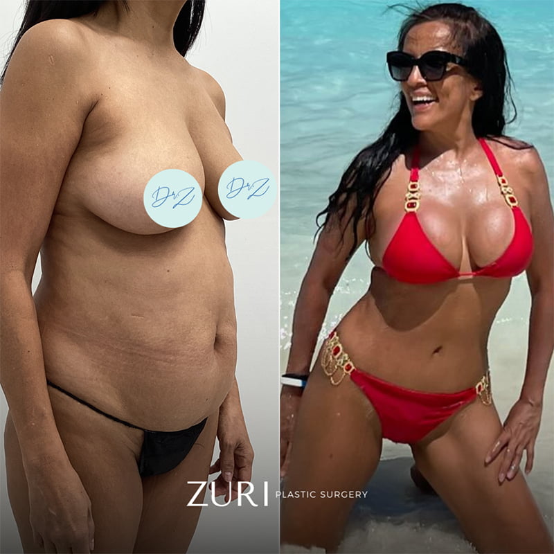 Featured before & after photo