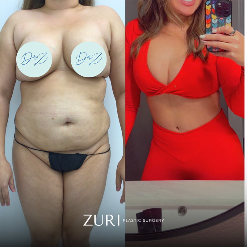 Featured before & after photo
